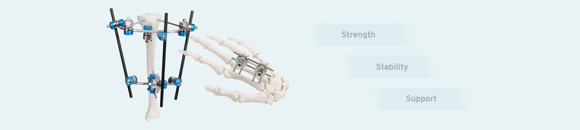 AO Configurations for various types of Fractures